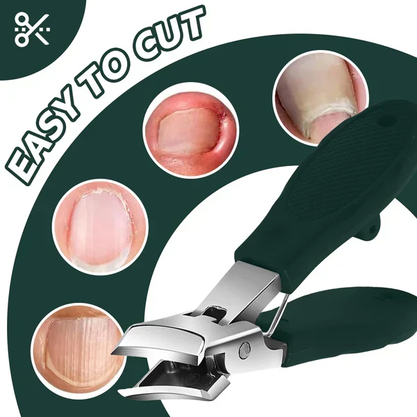 Nagelknipser mit schräger Schneide für präzise Ergebnisse | Extra breite Öffnung für dicke Fußnägel | Rutschfester PVC-Griff | Mit Spritzschutz