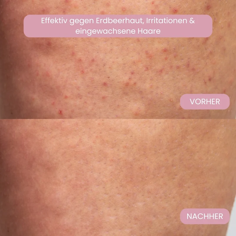 Elektrischer Intimrasierer für Frauen | 2-in-1 Bikini Trimmer für Nass & Trocken | kabellos, USB aufladbar, wasserfest