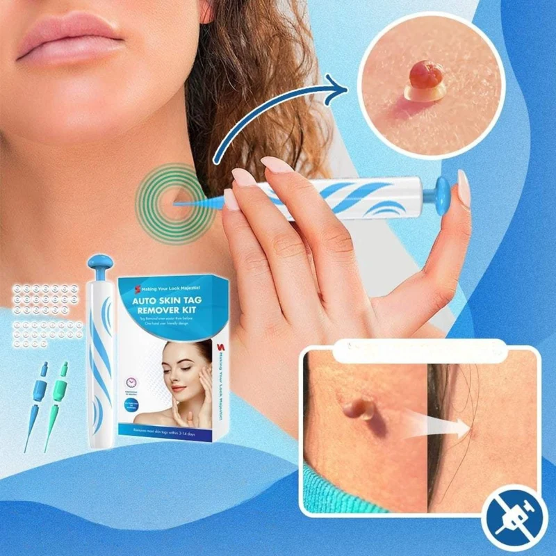 Hautanhängsel Entferner Set | sanfte Abbindung per Schlaufen-System | einfach anzuwenden zuhause | für Hals, Achseln & Körper