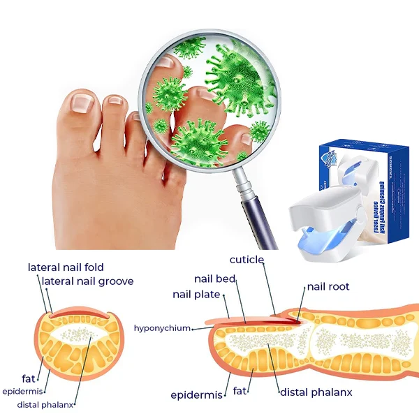 Lichttherapiegerät für Zehennägel mit Blaulicht & Infrarot | 470 nm & 650–1000 nm | Kompakt 90×63×38 mm | Für die Anwendung zu Hause