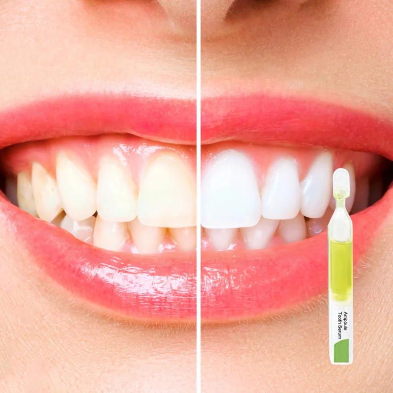 TLOPA Ampullenzahnpasta Whitening 1x | Minzgeschmack | Sanfte Formel | Entfernt Beläge, frischer Atem | 1 Stück, tägliche Anwendung