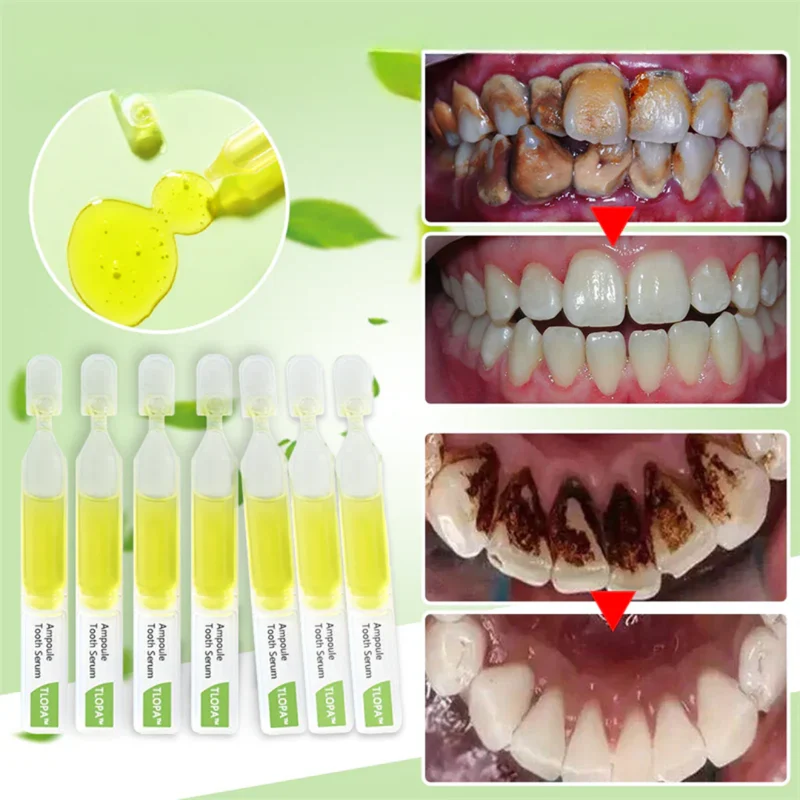 TLOPA Ampullenzahnpasta Whitening 1x | Minzgeschmack | Sanfte Formel | Entfernt Beläge, frischer Atem | 1 Stück, tägliche Anwendung