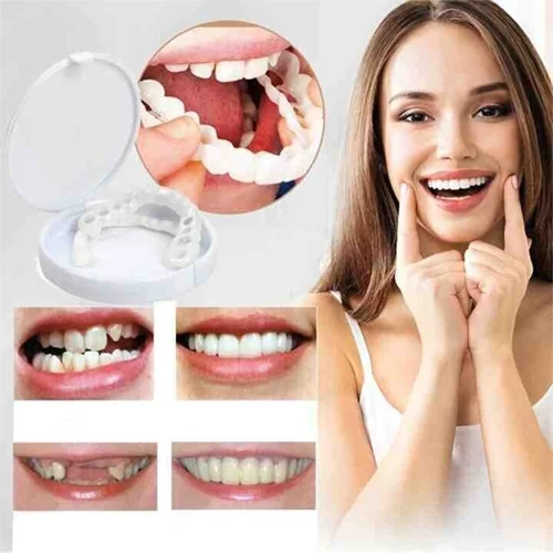 SnapSmile Aufsteck-Zahnprothese | Sofort natürliches Lächeln ohne Zahnarzt | Einstellbare Passform Realistischer Look Wiederverwendbar