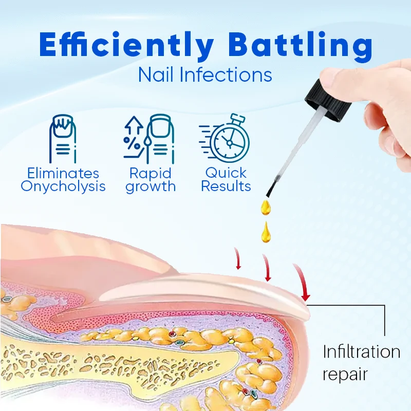 Nagelserum für Nagelwachstum & Reparatur | stärkende Nagelpflege mit Biotin & Feuchtigkeit | für brüchige Nägel & Nagelpflege zuhause