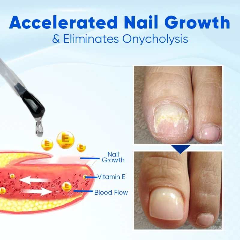 Nagelserum für Nagelwachstum & Reparatur | stärkende Nagelpflege mit Biotin & Feuchtigkeit | für brüchige Nägel & Nagelpflege zuhause