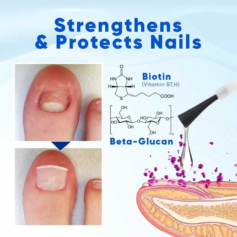 Nagelserum für Nagelwachstum & Reparatur | stärkende Nagelpflege mit Biotin & Feuchtigkeit | für brüchige Nägel & Nagelpflege zuhause