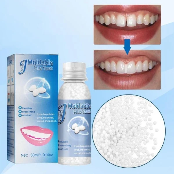 DIY Zahnreparatur Set kosmetisch | temporäre Zahnfüllung für fehlende Zähne | optisches Lächeln auffüllen | 30g