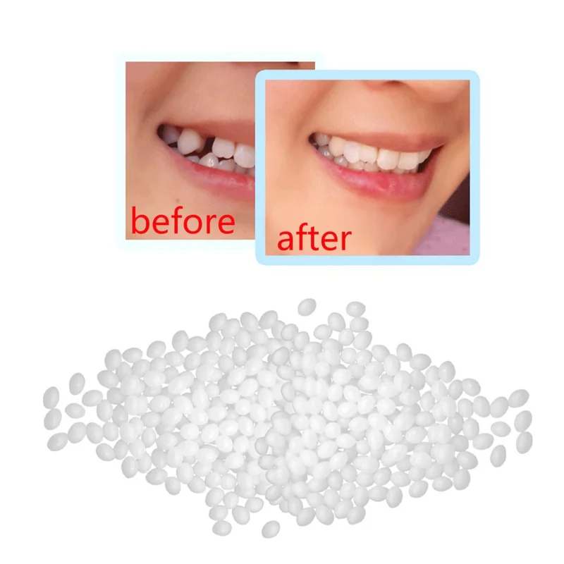 DIY Zahnreparatur Set kosmetisch | temporäre Zahnfüllung für fehlende Zähne | optisches Lächeln auffüllen | 30g