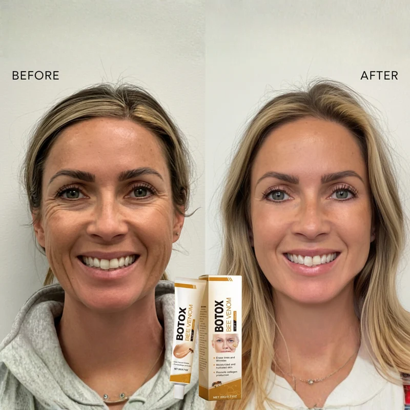 Anti-Aging-Creme mit Bienengift-Komplex | Strafft & festigt Gesicht und Hals | Mildert Fältchen und Linien | Leichte, nicht fettende Formel | 2× täglich