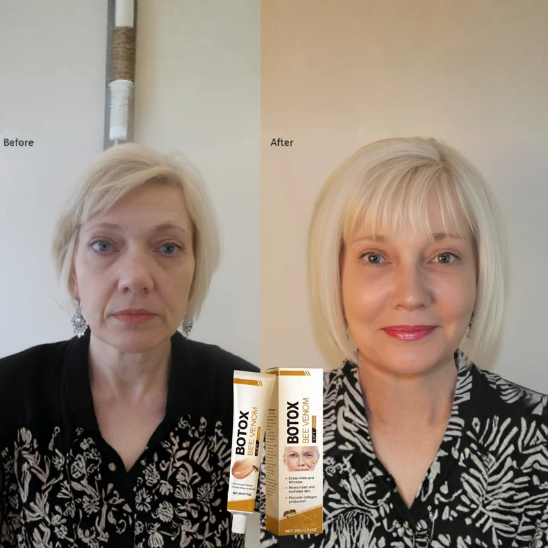Anti-Aging-Creme mit Bienengift-Komplex | Strafft & festigt Gesicht und Hals | Mildert Fältchen und Linien | Leichte, nicht fettende Formel | 2× täglich