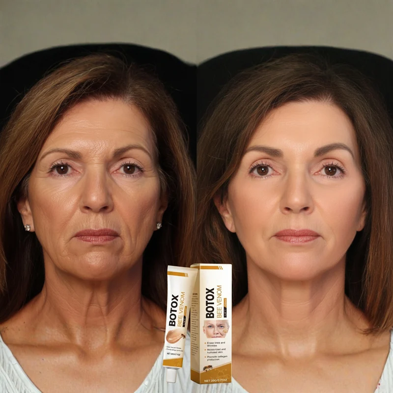 Anti-Aging-Creme mit Bienengift-Komplex | Strafft & festigt Gesicht und Hals | Mildert Fältchen und Linien | Leichte, nicht fettende Formel | 2× täglich
