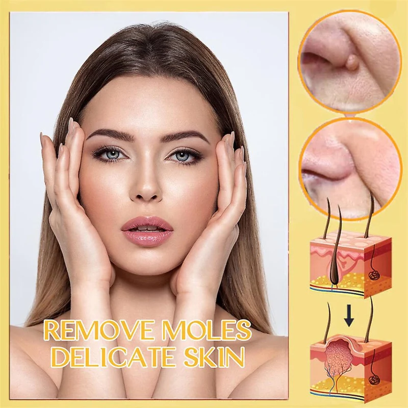 Pickel-Spot-Treatment-Gel | Mit Teebaumöl, Aloe Vera & Bienengift | Sanft zu empfindlichen Hautpartien | Parabenfrei