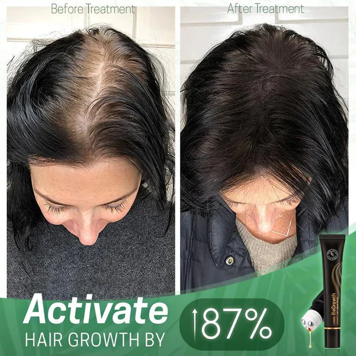Haarserum gegen Frizz und Trockenheit | Glanz-Boost-Leave-in-Serum | Leichtes Anti-Frizz-Serum | Für lockiges und glattes Haar