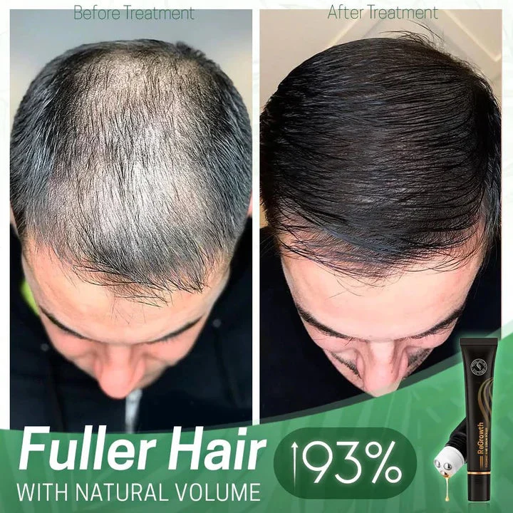 Haarserum gegen Frizz und Trockenheit | Glanz-Boost-Leave-in-Serum | Leichtes Anti-Frizz-Serum | Für lockiges und glattes Haar