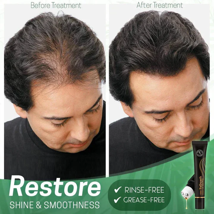Haarserum gegen Frizz und Trockenheit | Glanz-Boost-Leave-in-Serum | Leichtes Anti-Frizz-Serum | Für lockiges und glattes Haar