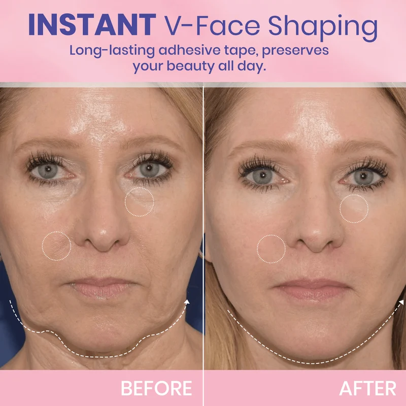 Unsichtbares Face Lift Tape V-Shape | Kinnlinie & Wangen liften | Wasser- & schweißfest