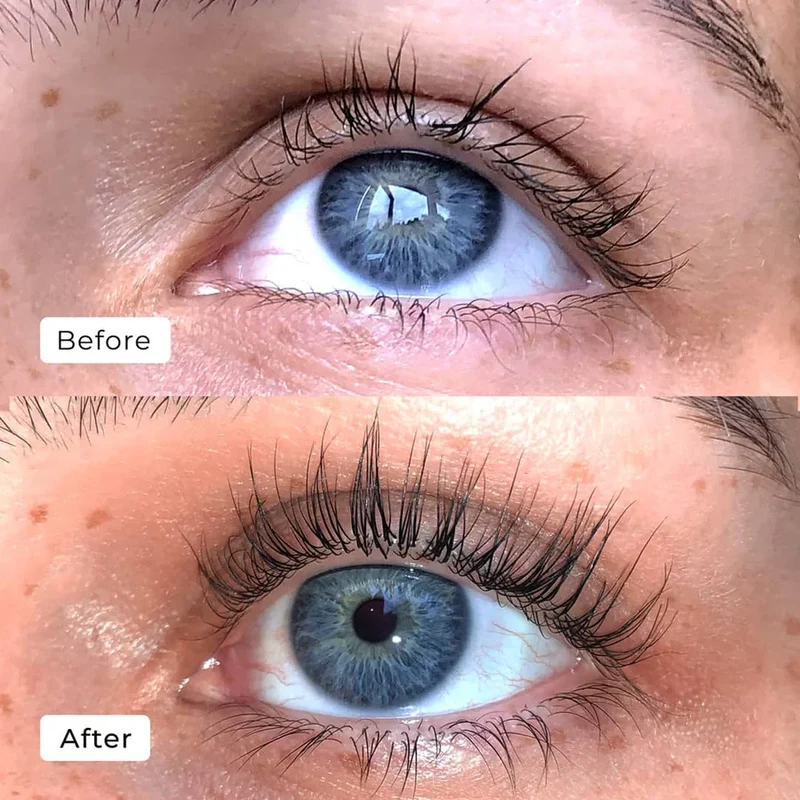 2+1 Gratis | WimpernWuchs™ Natürlicher Wimpernschub