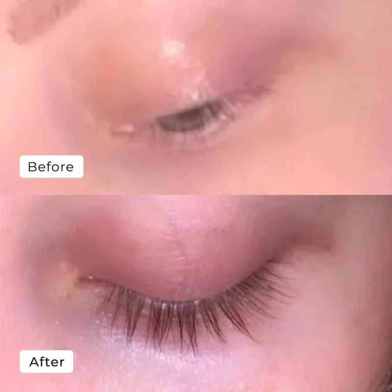 2+1 Gratis | WimpernWuchs™ Natürlicher Wimpernschub
