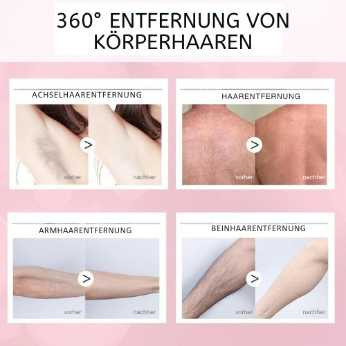 Haarentfernungsspray sanft & effektiv | mit Bienenwachs & Pflanzenextrakten | glatte Haut ohne Rasierbrand | für Körper & Gesicht
