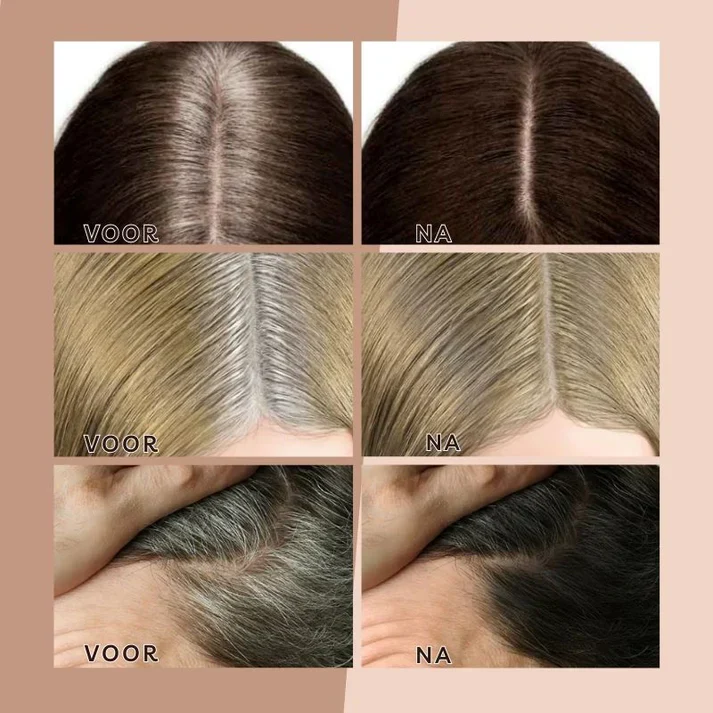 HaarBoost™ Lösung zur sofortigen Deckung von Nachwuchsproblemen