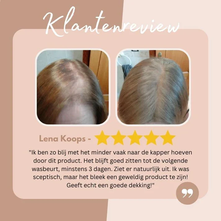 HaarBoost™ Lösung zur sofortigen Deckung von Nachwuchsproblemen