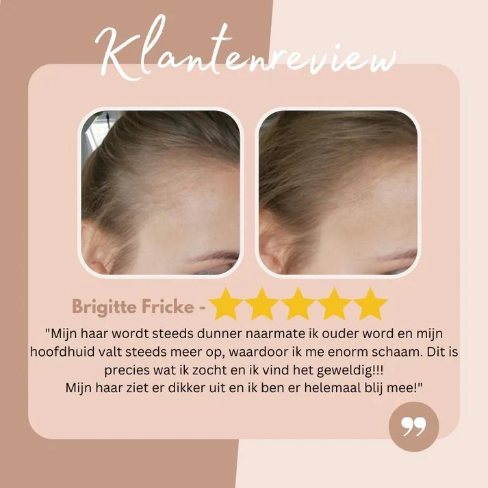 HaarBoost™ Lösung zur sofortigen Deckung von Nachwuchsproblemen
