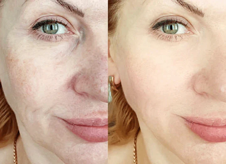 Kurkuma-Serum® Korrektur dunkler Flecken (1+1 Gratis)