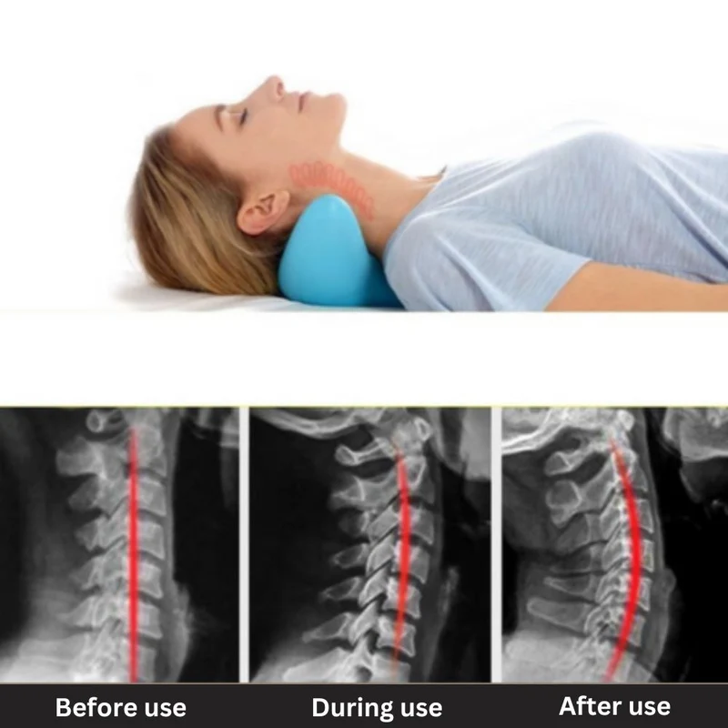 NeckHealth™ Nackenstützkissen