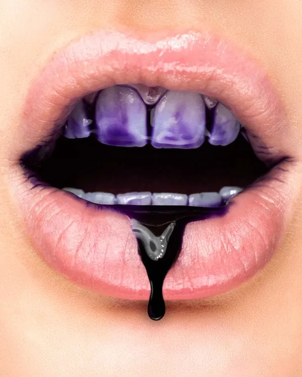 Zahnaufhellungs Gel sanft | Fleckenentfernung für weißere Zähne | Whitening Gel für Kaffee & Tee Verfärbungen