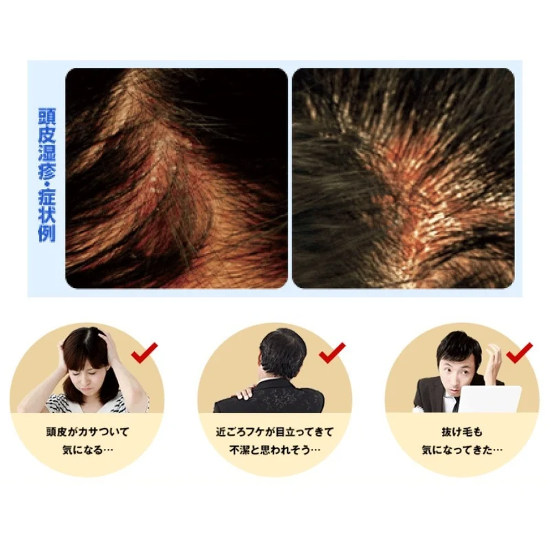MEDIQUICK H: Anti-dandruff/itching improves scalp environment shampoo 200ml