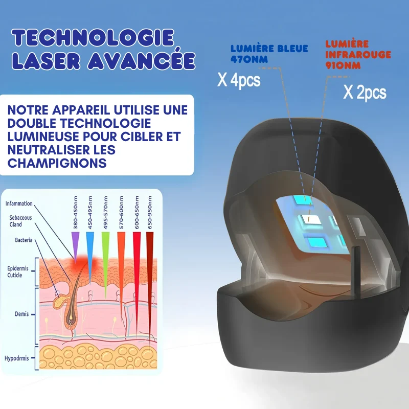 Dispositif de Traitement Laser pour Infections Fongiques
