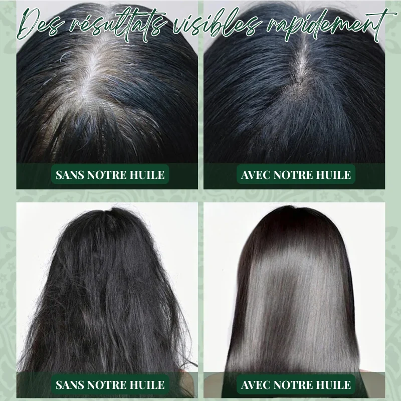 Huile Indienne de Pousse Cheveux