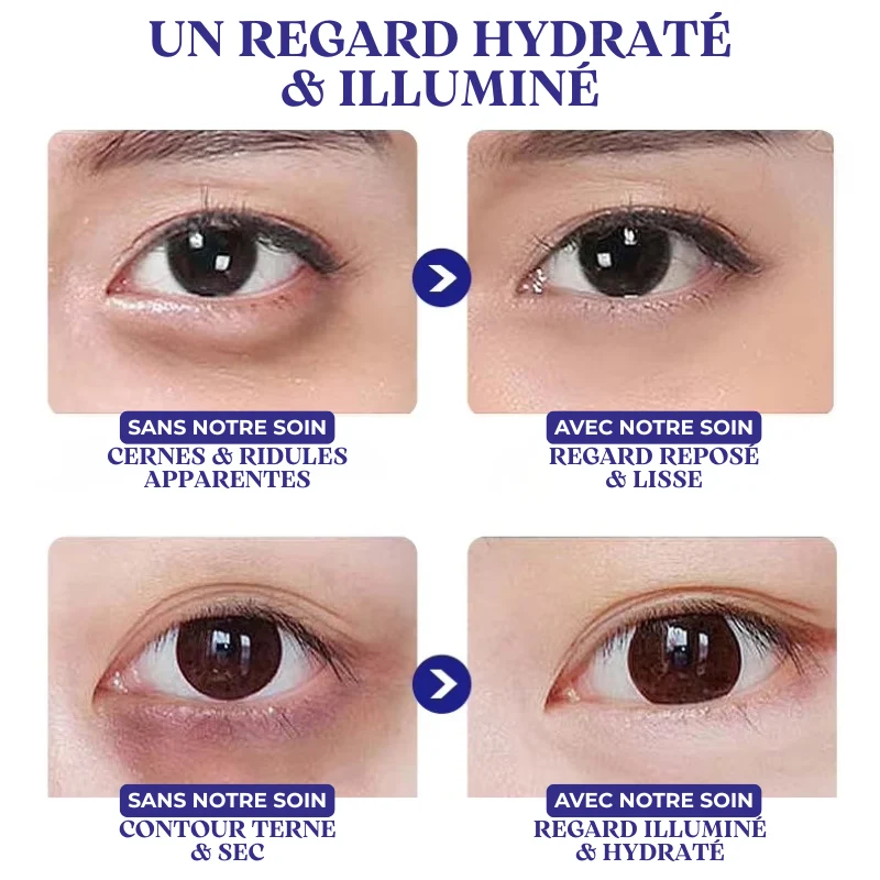 Crème pour les Yeux Anti-cernes au Collagène