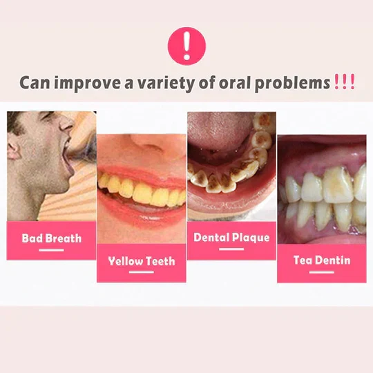 Rimuovi Placca Dentale