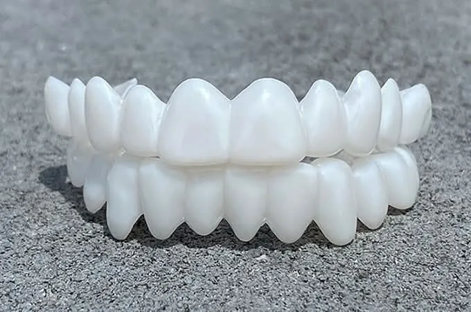 SmileFlex – Protesi dentale con lenti dentali bianche