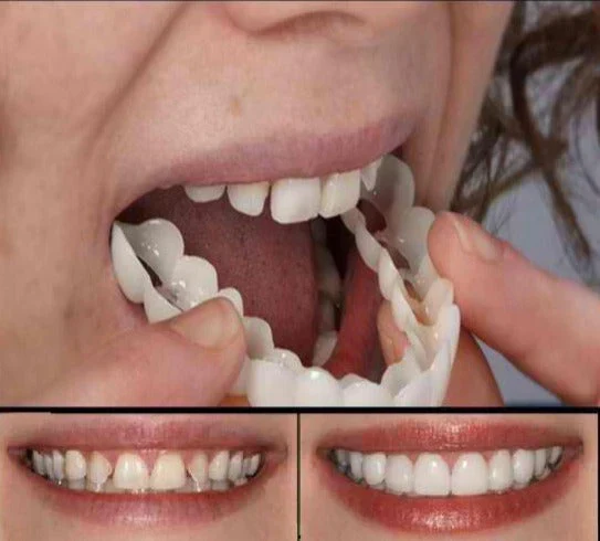 Fitflex Protesi Dentale