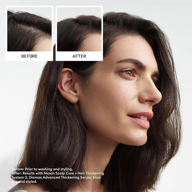 Trio shampoing, revitalisant et traitement pour cheveux et cuir chevelu Système 3 - Pour cheveux colorés avec chute modérée (2x 300ml/10.1oz, 1x 100ml/3.38oz)
