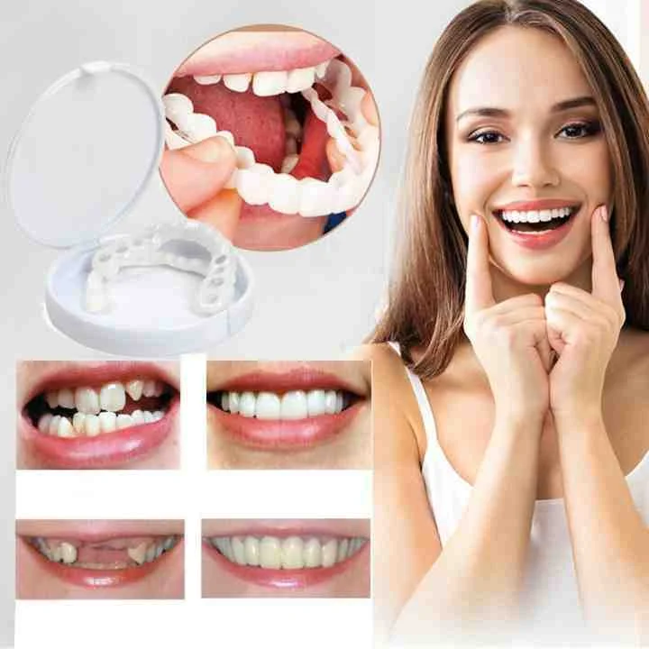 Copridenti per denti anteriori – Sottile, modellabile, con una presa sicura