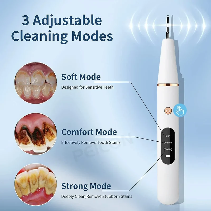 Pulitore per Denti Ultrasone - SonicClean