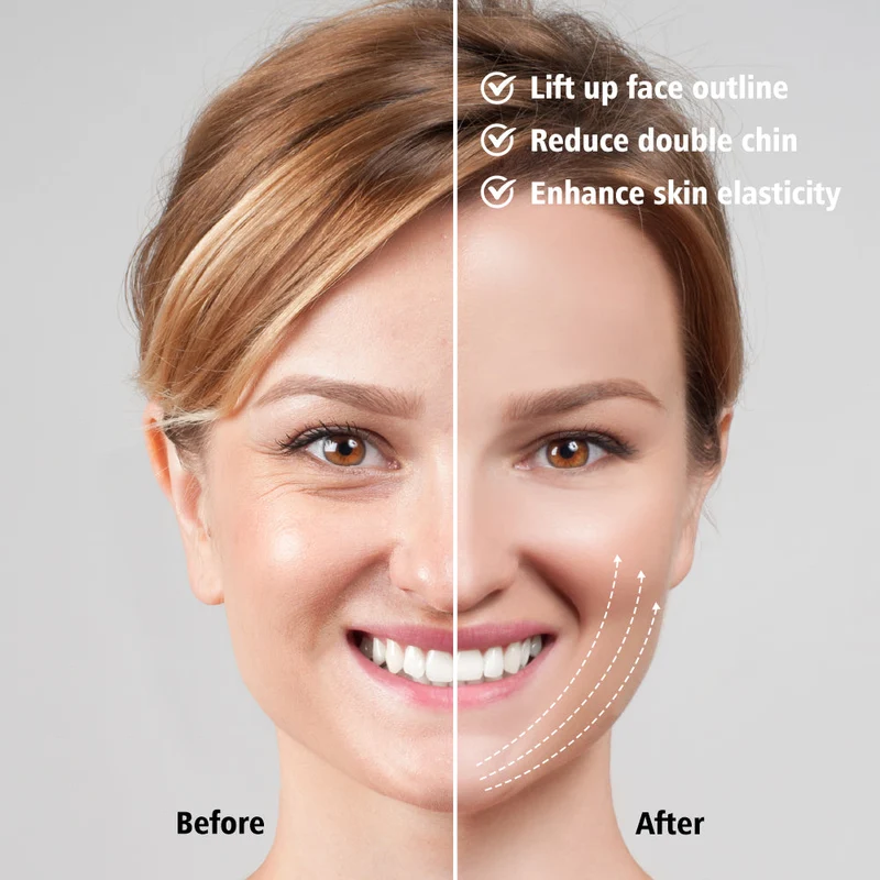 EMS Facial Slimmer con Terapia LED - Snellimento del Viso e Rimozione del Doppio Menton