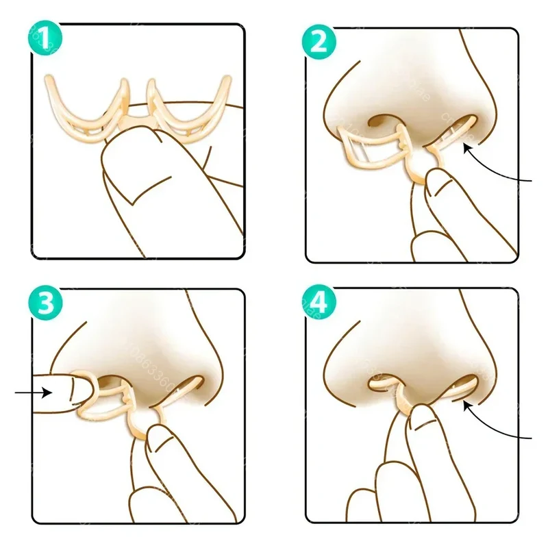 Dispositivo Antisnoring Confortevole – AirEase