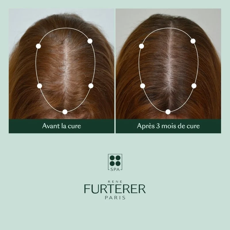 Shampoing épaississant "Triphasic" freine la perte de densité - Favorise la croissance des cheveux