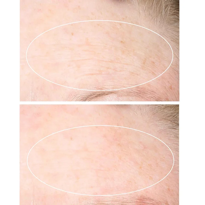 STRIVECTIN - Ensemble de 2 Soins Hydratants Intensif Anti-Rides et Anti-Vergetures SD Advanced Plus