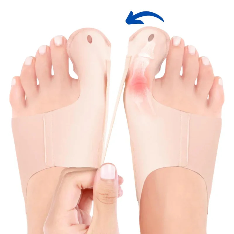 1+1 GRATIS | Hallux Valgus™ | La tua soluzione confortevole per piedi senza dolore!