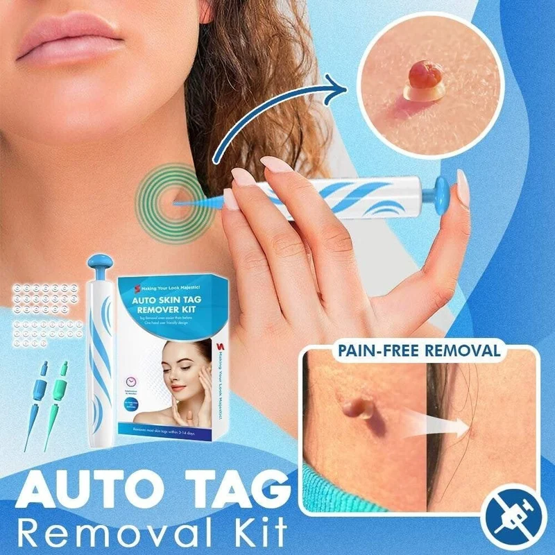 TagGone Kit per la rimozione automatica dei tag | Applicazione indolore | Per una pelle liscia e uniforme