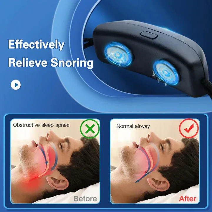 Dispositivo Smart Anti Ronzio EMS Pulse Stop Snore Portatile Comodo Sonno Bene Stop Snore Cura della Salute Aiuto per Apnea del Sonno USB