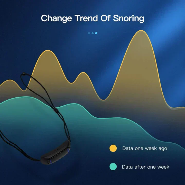 Dispositivo Smart Anti Ronzio EMS Pulse Stop Snore Portatile Comodo Sonno Bene Stop Snore Cura della Salute Aiuto per Apnea del Sonno USB
