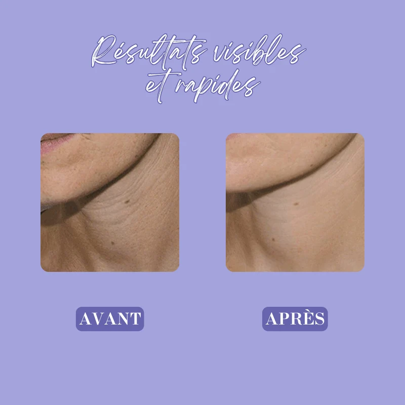 Crème anti-rides et raffermissante pour le cou