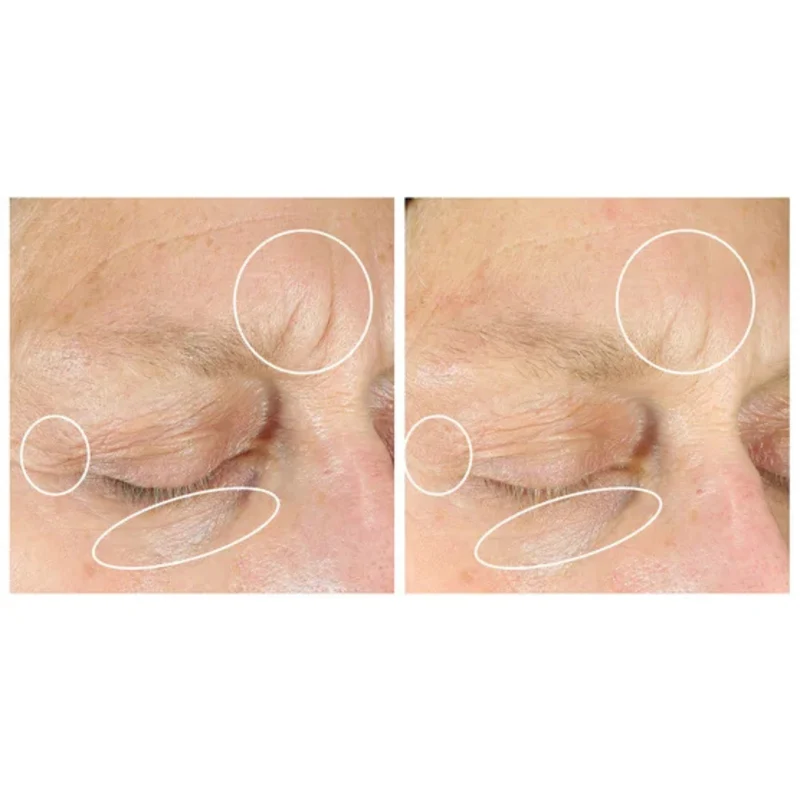 STRIVECTIN - Ensemble de 2 Soins Concentrés Intense pour les Yeux Anti-Rides
