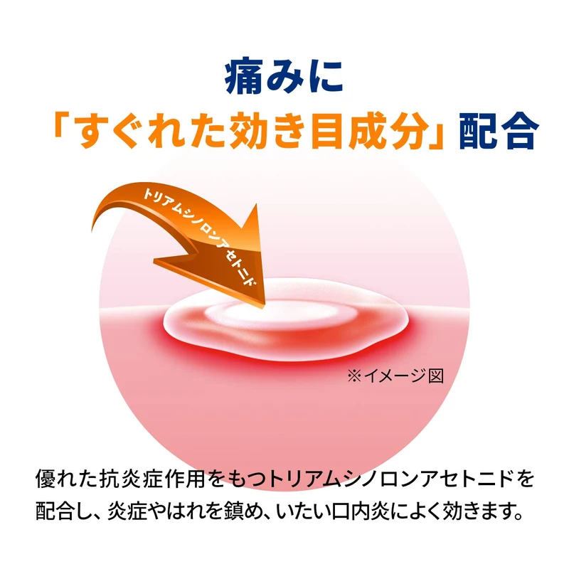 Sato Pharmaceutical Afutaguard 5G Oral Pain Relief Gel - [Class 2 OTC Drug]